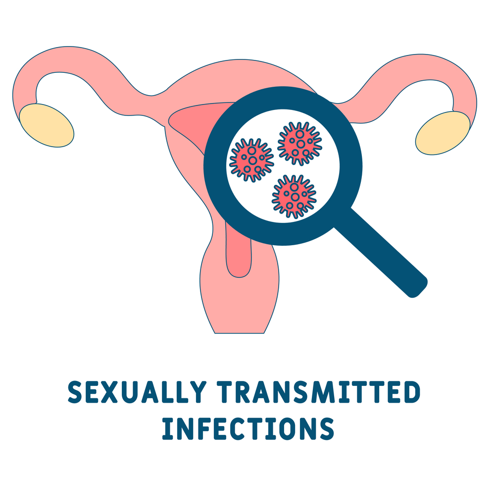 Can Sexually Transmitted Diseases Cause Infertility?