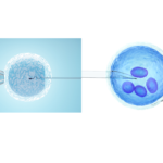ICSI Vs IVF Which Is Better?